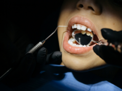 1-3 Yaş Diş Bakımı